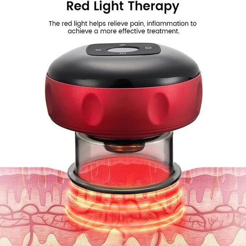 Electric Cupping Massage Therapy