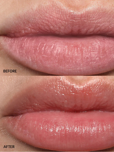 Lip Buff
