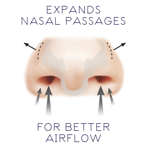 Nasal Dilator