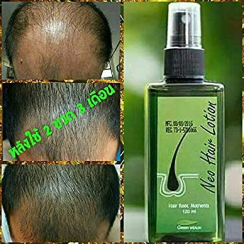 Neo Hair Lotion (120 ml)