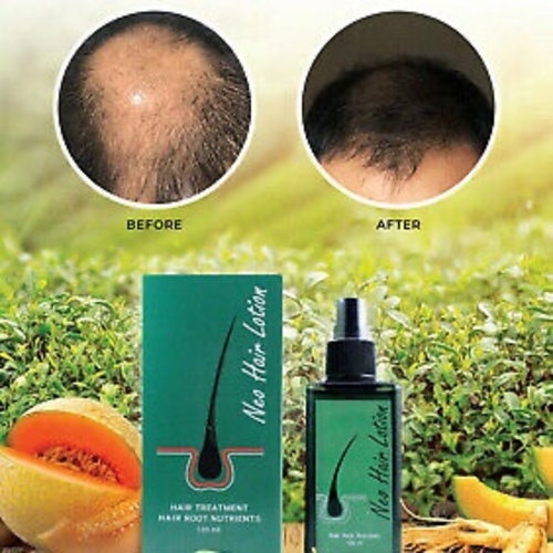 Neo Hair Lotion (120 ml)