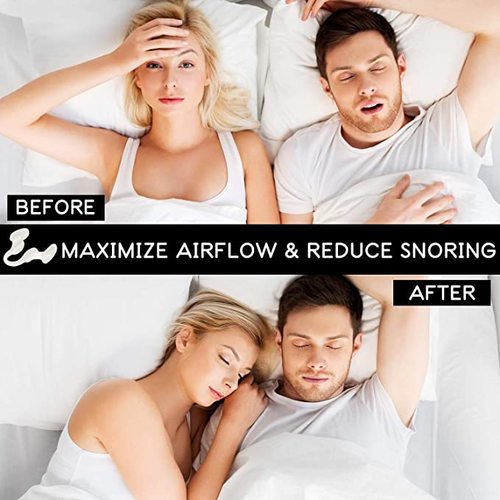 Nasal Dilator
