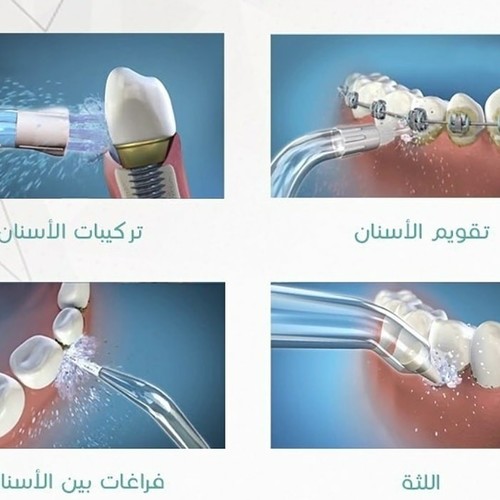 جهاز تنظيف الاسنان  الخيط المائي