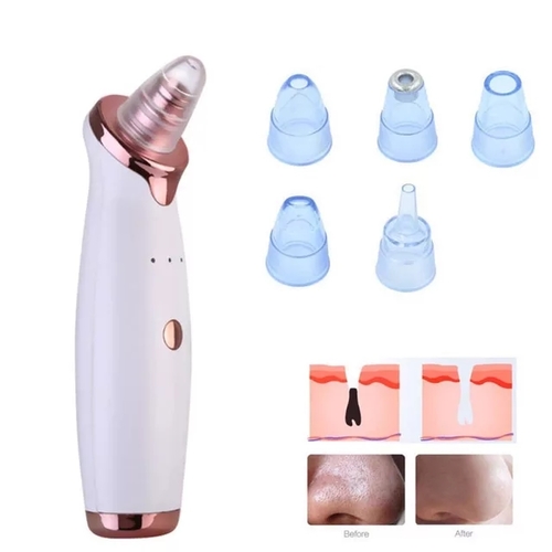 vaccum black head remover
