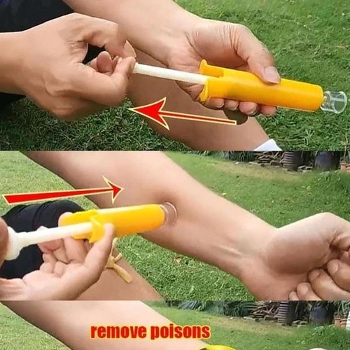 Bite venom suction device