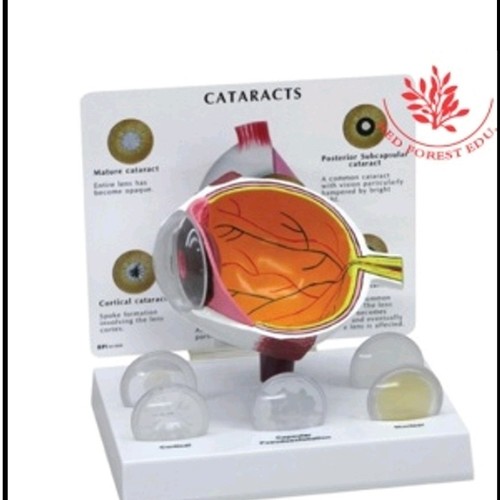 Medical Tech General Trading - anatomical Cataract eyeball model