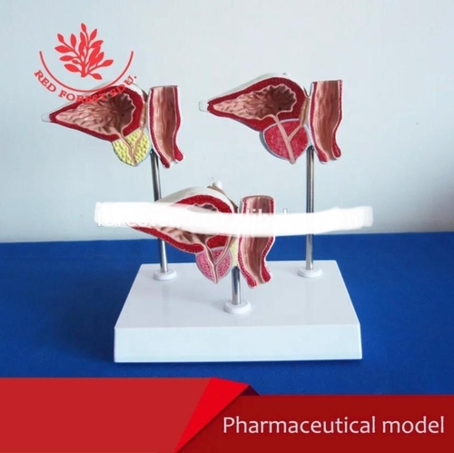 Medical Tech General Trading - Pathological prostate model