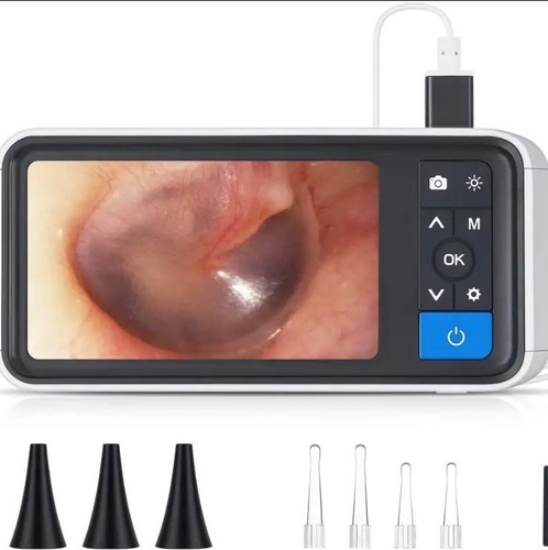 High resolution electronic ear endoscope