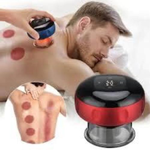 Smart cupping device