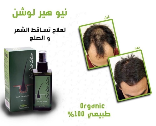 Neo Hair Lotion Herbs 100% Natural